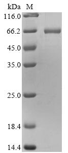 Mouse Vimentin (Vim) Recombinant Protein, MO-Mus musculus (Mouse), Mammalian cell, N-terminal 10xHis-tagged and C-terminal Myc-tagged, 58.6 kDa, purity >≥ 90% as determined by SDS-PAGE.