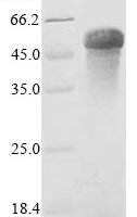 Mouse Properdin (Cfp) Recombinant Protein, C-Myc/C-His - BioCrest Sci