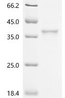 Mouse Aldo-keto reductase family 1 member A1 (Akr1a1) Recombinant Protein, C-His - BioCrest Sci