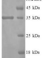 Human Protein disulfide-isomerase TMX3 (TMX3) Recombinant Protein - BioCrest Sci