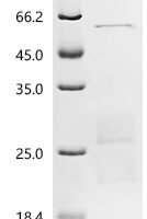 Human Ras-related protein Rab-6B (RAB6B) Recombinant Protein, N-His - BioCrest Sci
