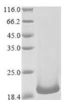 Human B melanoma antigen 2 (BAGE2) Recombinant Protein - BioCrest Sci