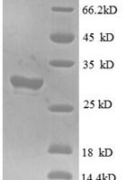 Human Interferon-induced transmembrane protein 1 (IFITM1), partial Recombinant Protein - BioCrest Sci