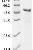 Escherichia coli Elongation factor Tu 1 (tufA) Recombinant Protein - BioCrest Sci