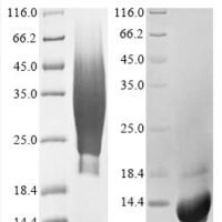 Human CD63 antigen (CD63), partial Recombinant Protein, N-His - BioCrest Sci