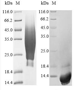 Human CD63 antigen (CD63), partial Recombinant Protein, N-His, Homo sapiens (Human), Yeast, N-terminal 6xHis-tagged, 13.5 kDa, purity >≥ 85% as determined by SDS-PAGE.