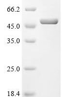 Human parainfluenza 3 virus Nucleoprotein (N), partial Recombinant Protein - BioCrest Sci
