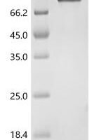 Human RecQ-like DNA helicase BLM (BLM), partial Recombinant Protein, C-hFc1 - BioCrest Sci