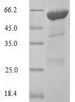 Human Phytanoyl-CoA dioxygenase, peroxisomal (PHYH) Recombinant Protein - BioCrest Sci