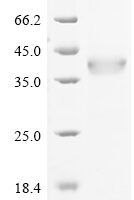 Human Integrin alpha-M (ITGAM), partial Recombinant Protein, N-His-GST - BioCrest Sci