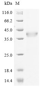 Human Integrin alpha-M (ITGAM), partial Recombinant Protein, N-His-GST, Homo sapiens (Human), E.coli, N-terminal 6xHis-GST-tagged, 57.1 kDa, purity >≥ 90% as determined by SDS-PAGE.