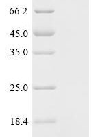 Mycobacterium tuberculosis Metallothionein (mymT) Recombinant Protein, C-His - BioCrest Sci