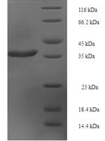 Human Rab-like protein 5 (RABL5) Recombinant Protein - BioCrest Sci