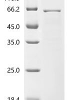 Human Nucleoporin p54 (NUP54) Recombinant Protein - BioCrest Sci