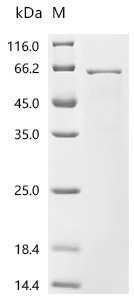 Human Nucleoporin p54 (NUP54) Recombinant Protein, Homo sapiens (Human), E.coli, C-terminal 6xHis-tagged, 62.4 kDa, purity >≥ 85% as determined by SDS-PAGE.