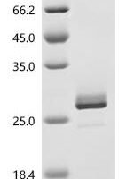 Human Heterogeneous nuclear ribonucleoproteins A2/B1 (HNRNPA2B1), partial Recombinant Protein, C-10His - BioCrest Sci