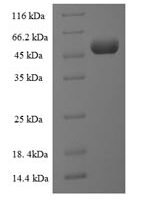 Human Long-chain fatty acid transport protein 2 (SLC27A2), partial Recombinant Protein, N-His-SUMO - BioCrest Sci