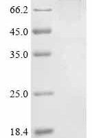 Human Bone morphogenetic protein 1 (BMP1) Recombinant Protein, N-hFc1 - BioCrest Sci
