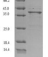 Staphylococcus aureus Staphylococcal secretory antigen ssaA2 (ssaA2) Recombinant Protein - BioCrest Sci