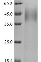 Human Protein mono-ADP-ribosyltransferase PARP14 (PARP14), partial Recombinant Protein, N-10His/C-Myc, aa 1605–1801, Mammalian cell - BioCrest Sci