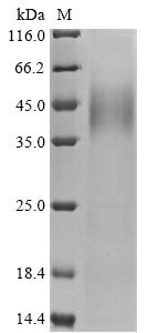 Human Protein mono-ADP-ribosyltransferase PARP14 (PARP14), partial Recombinant Protein, N-10His/C-Myc, aa 1605–1801, Mammalian cell, Homo sapiens (Human), Mammalian cell, N-terminal 10xHis-tagged and C-terminal Myc-tagged, 27.6 kDa, purity >≥ 90% as determined by SDS-PAGE.