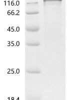 Human Proto-oncogene tyrosine-protein kinase receptor Ret (RET), partial Recombinant Protein, C-hFc1 - BioCrest Sci
