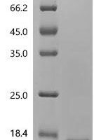 Rat Interleukin-2 (Il2) Recombinant Protein, C-10His - BioCrest Sci