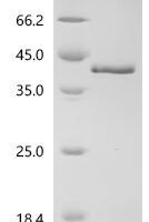 Human Prickle-like protein 2 (PRICKLE2), partial Recombinant Protein, N-10His/C-Myc - BioCrest Sci