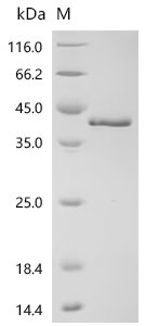 Human Prickle-like protein 2 (PRICKLE2), partial Recombinant Protein, N-10His/C-Myc, Homo sapiens (Human), E.coli, N-terminal 10xHis-tagged and C-terminal Myc-tagged, 37.9 kDa, purity >≥ 95% as determined by SDS-PAGE.