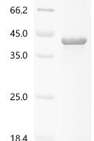 Spirometra erinaceieuropaei Cysteine proteinase Recombinant Protein, N-His - BioCrest Sci