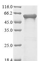 Human Hepatocyte nuclear factor 3-alpha (FOXA1) Recombinant Protein, N-10His/C-Myc - BioCrest Sci