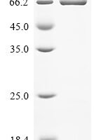 Human Signal transducer and activator of transcription 3 (STAT3), partial Recombinant Protein - BioCrest Sci