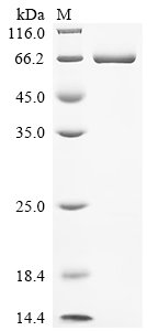Human Signal transducer and activator of transcription 3 (STAT3), partial Recombinant Protein, Homo sapiens (Human), E.coli, N-terminal 6xHis-tagged, 68.4 kDa, purity >≥ 90% as determined by SDS-PAGE.