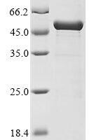 Human Blood group Rh (D) polypeptide (RHD), partial,Biotinylated Recombinant Protein - BioCrest Sci