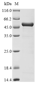 Human Blood group Rh (D) polypeptide (RHD), partial,Biotinylated Recombinant Protein, Homo sapiens (Human), E.coli, N-terminal MBP-tagged and C-terminal 6xHis-Avi-tagged, 51.4 kDa, purity >≥ 85% as determined by SDS-PAGE.