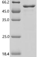 Human Histone deacetylase 3 (HDAC3) Recombinant Protein, C-His - BioCrest Sci