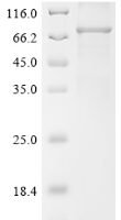 Mouse Sushi repeat-containing protein SRPX2 (Srpx2) Recombinant Protein, N-10His-SUMO/C-Myc - BioCrest Sci
