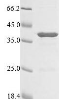 Escherichia coli Colicin-E1 (cea), partial Recombinant Protein - BioCrest Sci