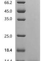 Human Coagulation factor IX (F9), partial Recombinant Protein, C-10His, aa 93–129, Mammalian cell - BioCrest Sci