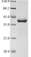 Escherichia coli O6:H1 Probable L,D-transpeptidase YbiS (ybiS) Recombinant Protein - BioCrest Sci
