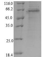Human Runt-related transcription factor 3 (RUNX3) Recombinant Protein - BioCrest Sci
