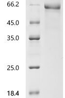 Human Apolipoprotein E (APOE) Recombinant Protein - BioCrest Sci