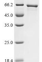 Human E3 ubiquitin-protein ligase makorin-1 (MKRN1) Recombinant Protein - BioCrest Sci