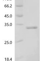 Escherichia coli Orotidine 5'-phosphate decarboxylase (pyrF) Recombinant Protein - BioCrest Sci