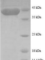 Human Rhombotin-1 (LMO1), partial Recombinant Protein - BioCrest Sci