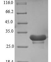 Human U1 small nuclear ribonucleoprotein 70 kDa (SNRNP70), partial Recombinant Protein - BioCrest Sci
