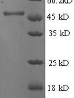 Human 4-hydroxyphenylpyruvate dioxygenase (HPD) Recombinant Protein - BioCrest Sci