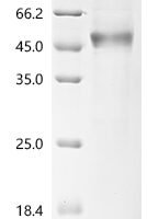 Human Secreted and transmembrane protein 1 (SECTM1), partial, Biotinylated Recombinant Protein - BioCrest Sci
