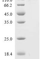 Dog Heat shock protein 90 alpha family class A member 1 (HSP90AA1), Biotinylated Recombinant Protein - BioCrest Sci
