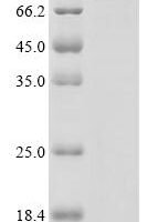 Human Muscle, skeletal receptor tyrosine-protein kinase (MUSK), partial, Biotinylated Recombinant Protein - BioCrest Sci